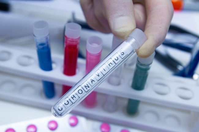 Sample from coronavirus-infected Chinese woman to be sent for foreign testing