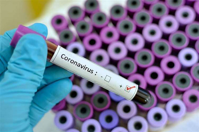Confirmed Covid-19 cases in Sri Lanka climb to 50