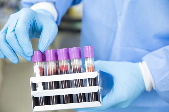 Two more COVID-19 cases bring total to 106