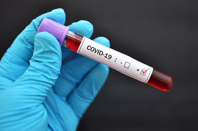 COVID-19: Total positive cases in Sri Lanka surge to 156