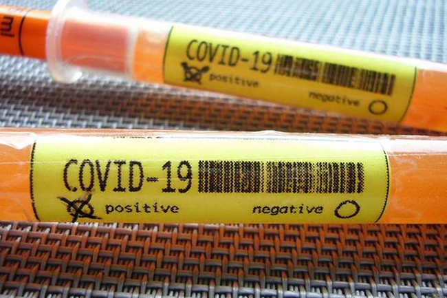 Two new COVID-19 patients found; Total rises to 271