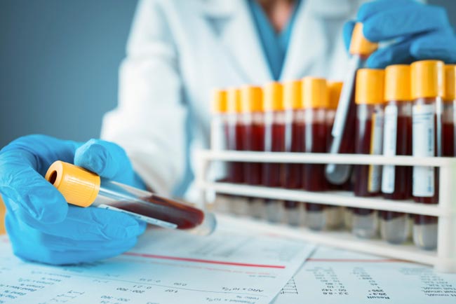 COVID-19: Two new cases, seven recoveries