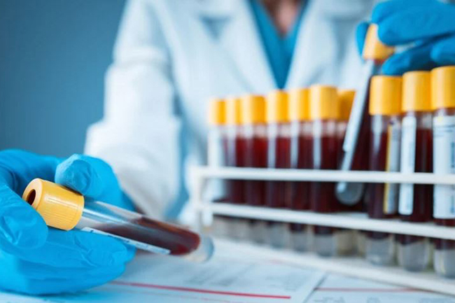 Twenty more test positive for COVID-19 as tally leaps to 1,138