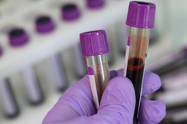 Two more test positive for coronavirus as tally hits 1,806