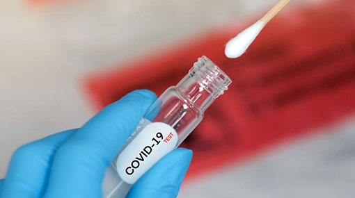 Sri Lanka’s Covid-19 cases tally climbs to 2,080