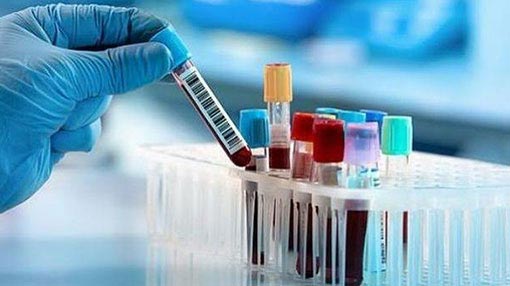 More COVID-19 cases hike case count