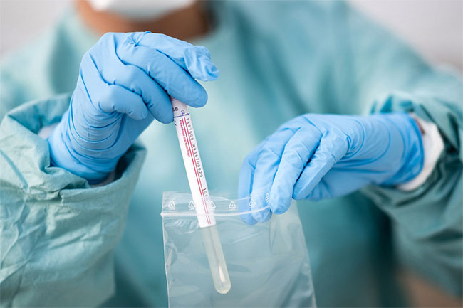 1,742 new cases of Covid-19 confirmed