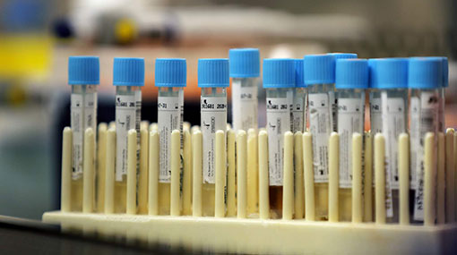 677 new cases of Covid-19 reported in Sri Lanka