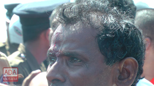 Twenty-one hospitalized after clashes in Hambantota